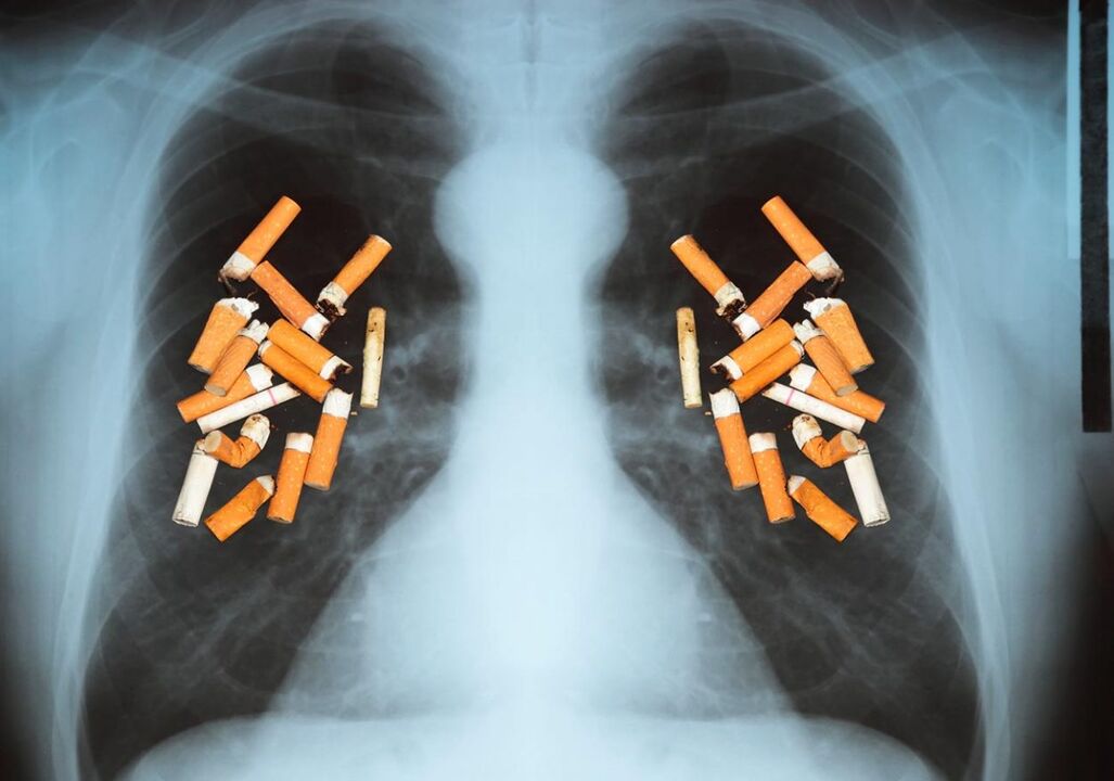 Ako cigarety ovplyvňujú pľúca